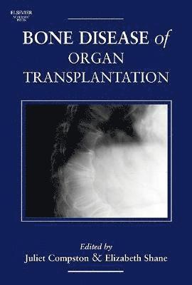 bokomslag Bone Disease of Organ Transplantation