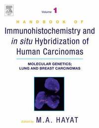 bokomslag Handbook of Immunohistochemistry and in Situ Hybridization of Human Carcinomas