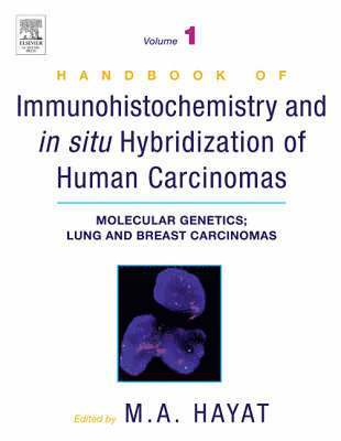 Handbook of Immunohistochemistry and in Situ Hybridization of Human Carcinomas 1