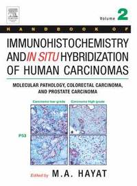 bokomslag Handbook of Immunohistochemistry and in Situ Hybridization of Human Carcinomas