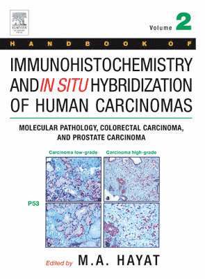 bokomslag Handbook of Immunohistochemistry and in Situ Hybridization of Human Carcinomas