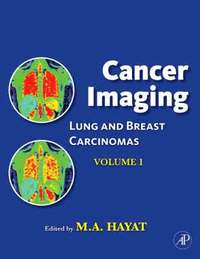 bokomslag Cancer Imaging