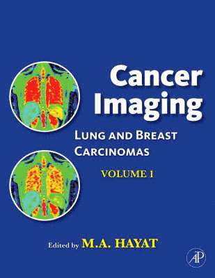 bokomslag Cancer Imaging