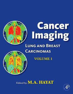 Cancer Imaging 1
