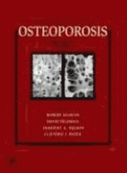 Robert Marcus, David Feldman, Dorothy Nelson, Clifford Rosen - Osteoporosis, Inbunden