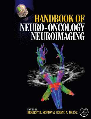 Herbert B. Newton - Handbook of Neuro-Oncology Neuroimaging, Inbunden