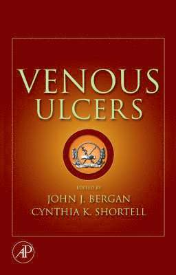 John J. Bergan, Cynthia K. Shortell, John J Bergan, Cynthia K Shortell - Venous Ulcers, Inbunden