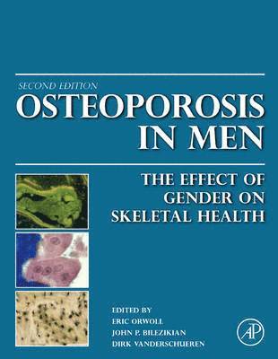 Eric S. Orwoll, John P. Bilezikian, Dirk Vanderschueren, Eric S Orwoll, John P Bilezikian - Osteoporosis in Men, Inbunden