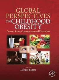 bokomslag Global Perspectives on Childhood Obesity