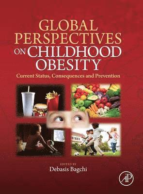 Debasis Bagchi - Global Perspectives on Childhood Obesity, Inbunden