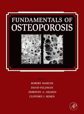 Robert Marcus, David Feldman, Dorothy Nelson, Clifford Rosen - Fundamentals of Osteoporosis, Inbunden