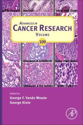 George F. Vande Woude, George Klein - Advances in Cancer Research, Inbunden