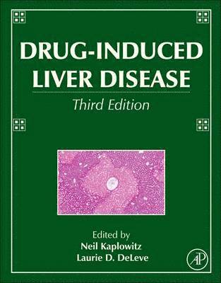 bokomslag Drug-Induced Liver Disease