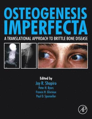 Javaid Kassim, Paul Sponseller, Jay R. Shapiro - Osteogenesis Imperfecta, Inbunden