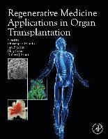 Regenerative Medicine Applications in Organ Transplantation 1