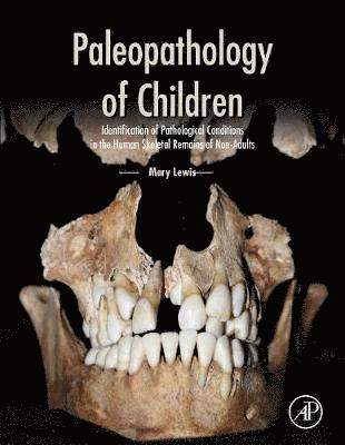 bokomslag Paleopathology of Children