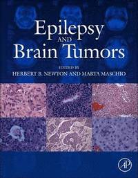 bokomslag Epilepsy and Brain Tumors