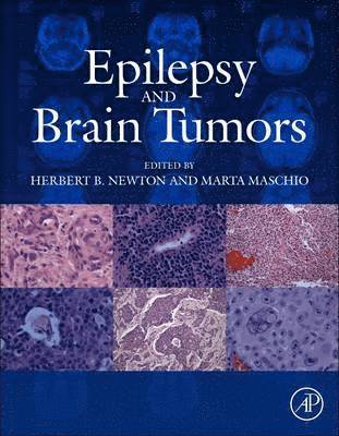 Epilepsy and Brain Tumors 1