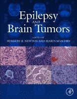 Herbert B. Newton, Marta Maschio, Herbert B Newton - Epilepsy and Brain Tumors, Inbunden