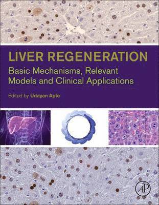 Liver Regeneration 1