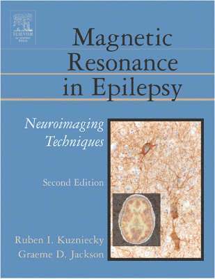 Magnetic Resonance in Epilepsy 1