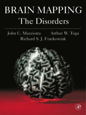 Brain Mapping: The Disorders 1