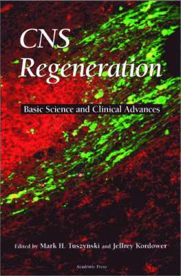 Mark H. Tuszynski, Jeffrey Kordower - CNS Regeneration, Inbunden