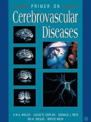 Louis R. Caplan, Bo K. Siesjo, Bruce Weir, K. Michael Welch, Donald J. Reis, Bo K Siesjo, K Michael Welch, Louis R Caplan, Donald J Reis - Primer on Cerebrovascular Diseases, Häftad