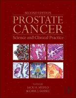 Jack H. Mydlo, Ciril J. Godec - Prostate Cancer, Inbunden