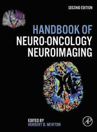 bokomslag Handbook of Neuro-Oncology Neuroimaging