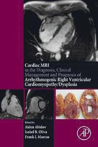 bokomslag Cardiac MRI in Diagnosis, Clinical Management, and Prognosis of Arrhythmogenic Right Ventricular Cardiomyopathy/Dysplasia