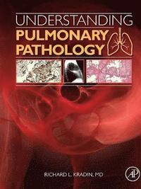 bokomslag Understanding Pulmonary Pathology