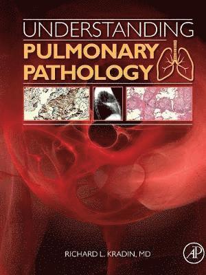 Understanding Pulmonary Pathology 1