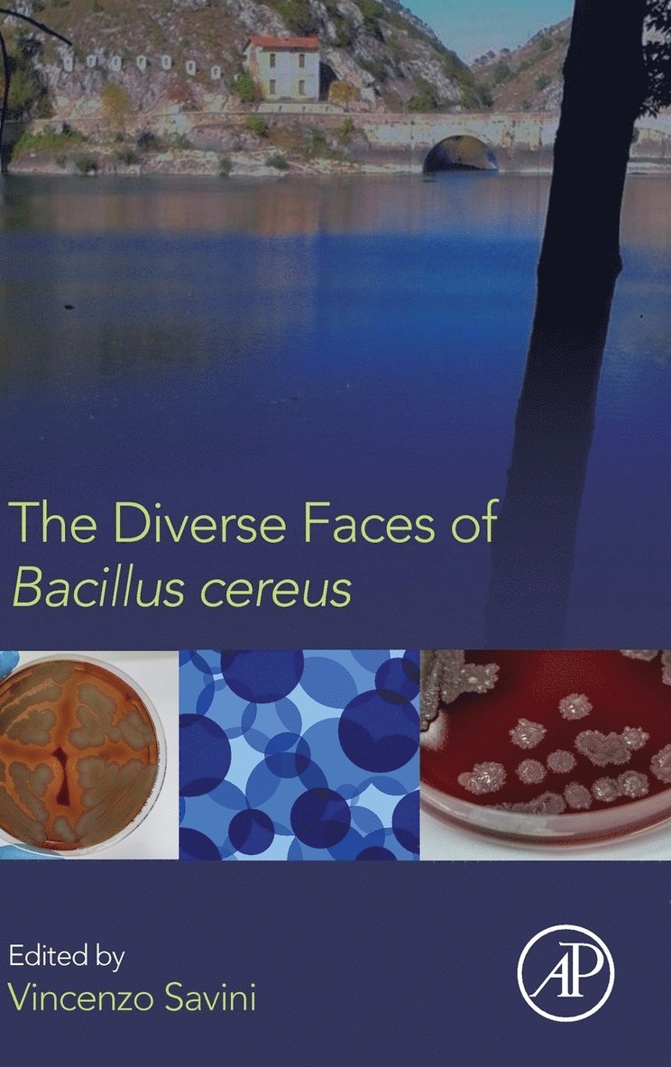 Diverse Faces of Bacillus Cereus 1