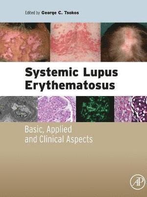 bokomslag Systemic Lupus Erythematosus