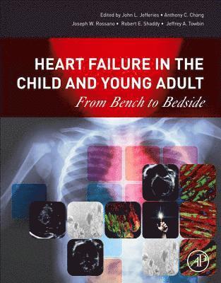 Joseph Rossano, John Lynn Jefferies, Anthony C. Chang, Jeffrey A. Towbin, Robert E Shaddy, Robert E. Shaddy - Heart Failure in the Child and Young Adult, Häftad