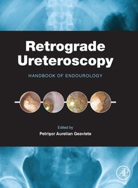 bokomslag Retrograde Ureteroscopy