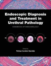 bokomslag Endoscopic Diagnosis and Treatment in Urethral Pathology
