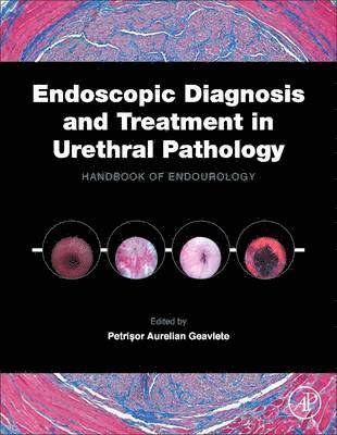 Endoscopic Diagnosis and Treatment in Urethral Pathology 1