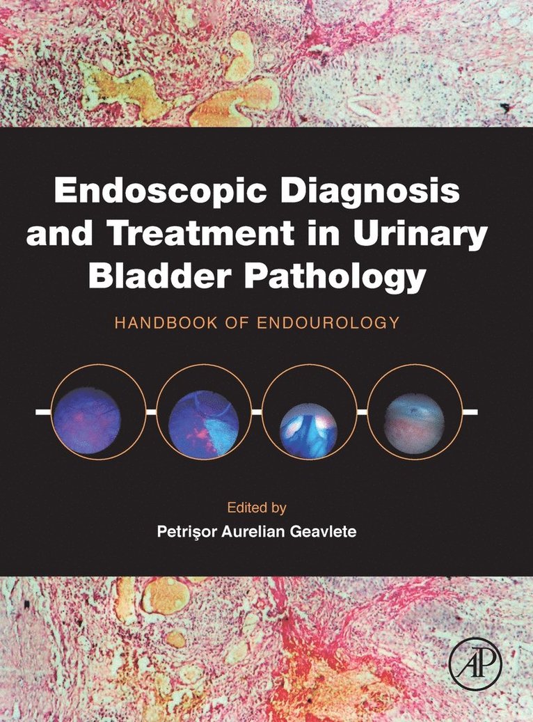 Endoscopic Diagnosis and Treatment in Urinary Bladder Pathology 1