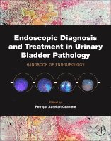 Petrisor Aurelian Geavlete, Romania) Geavlete, Petrisor Aurelian (Department of Urology, Faculty of Medicine, University of Medicine and Pharmacy Carol Davila Bucharest, Bucharest - Endoscopic Diagnosis and Treatment in Urinary Bladder Pathology, Inbunden