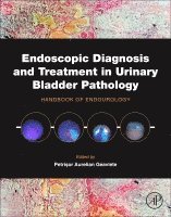 Endoscopic Diagnosis and Treatment in Urinary Bladder Pathology 1