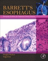 bokomslag Barrett's Esophagus