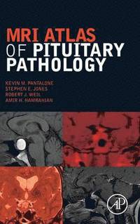 bokomslag MRI Atlas of Pituitary Pathology