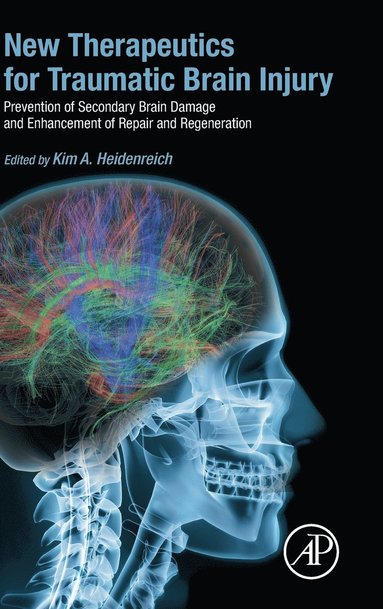 bokomslag New Therapeutics for Traumatic Brain Injury