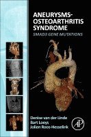 Denise van der Linde, Jolien Roos-Hesselink, Bart L. Loeys, Denise Van Der Linde, Denise van der Linde, Bart L Loeys - Aneurysms-Osteoarthritis Syndrome, Häftad
