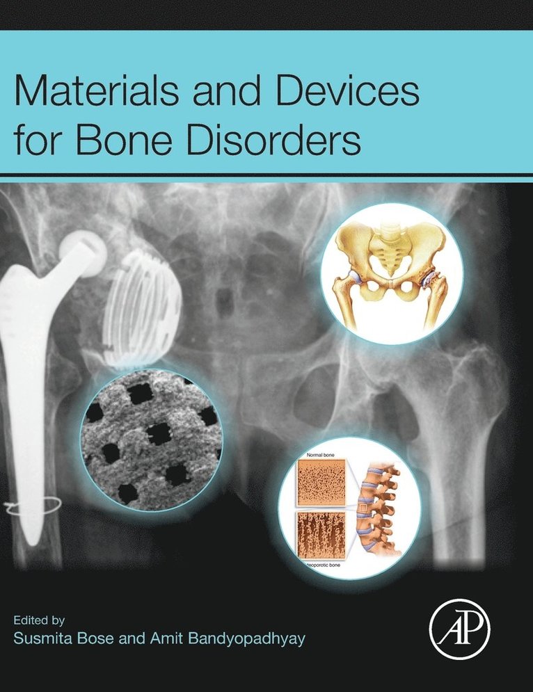 Materials and Devices for Bone Disorders 1