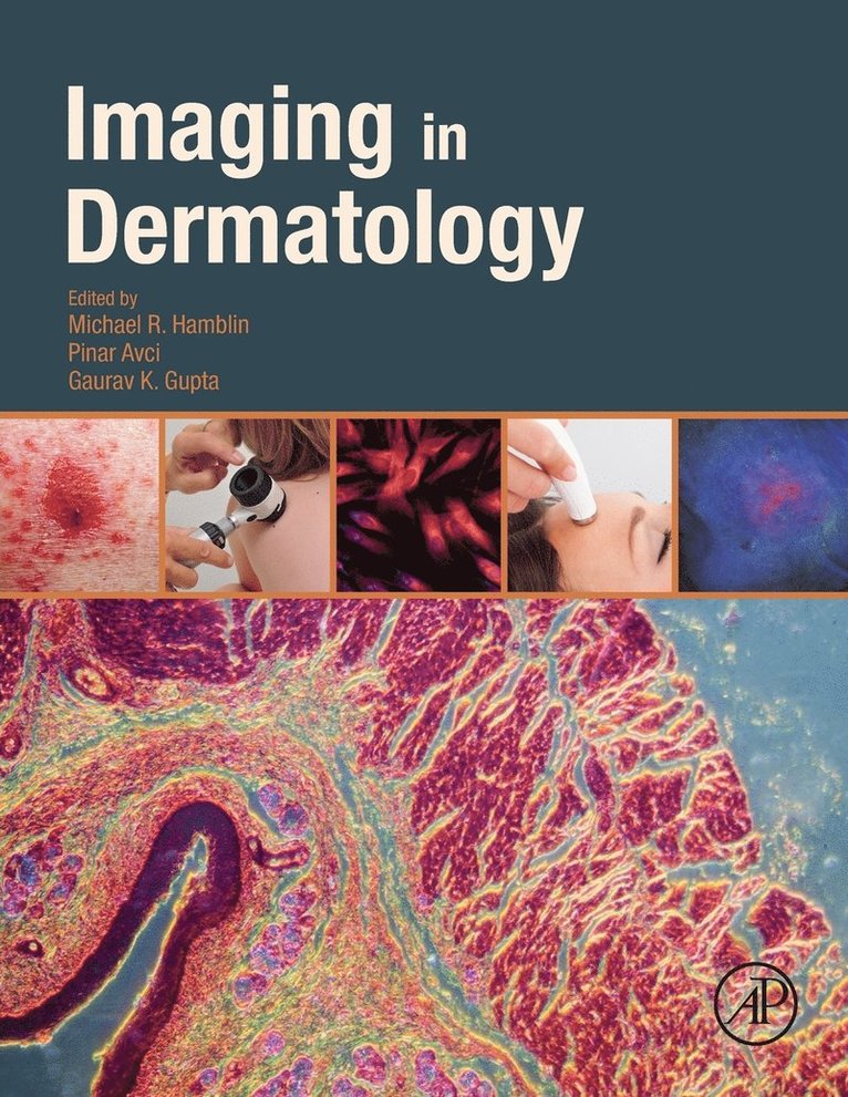 Imaging in Dermatology 1