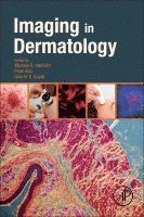 Imaging in Dermatology 1