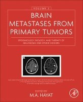 bokomslag Brain Metastases from Primary Tumors, Volume 3